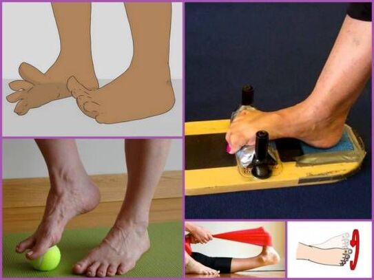 Exercise therapy for the treatment of flat and valgus deformity of the foot
