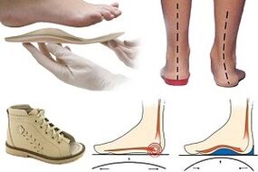 Children's bunion orthopedic shoes