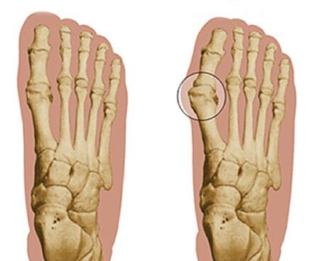 The development of feet